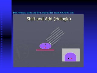Ben Johnson, Barts and the London NHS Trust, UKMPG 2011
 