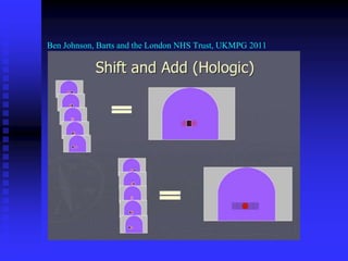 Ben Johnson, Barts and the London NHS Trust, UKMPG 2011
 