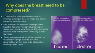 Why does the breast need to be
compressed?
 * Compression holds the breast in place to
minimize blurring of the x-ray image that can be
caused by patient motion.
 Also, compression evens out the shape of the
breast so that the x-rays can travel through a
shorter path to reach the detector. This reduces the
radiation dose and improves the quality of the x-
ray image.
 Finally, compression allows all the tissues to be
visualized in a single plane so that small
abnormalities are less likely to be obscured by
overlying breast tissue.
 
