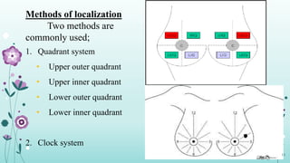 Methods of localization
Two methods are
commonly used;
1. Quadrant system
• Upper outer quadrant
• Upper inner quadrant
• Lower outer quadrant
• Lower inner quadrant
2. Clock system
13
 