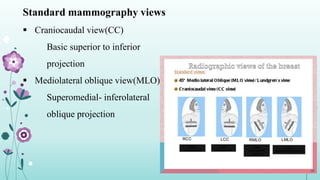 Standard mammography views
 Craniocaudal view(CC)
Basic superior to inferior
projection
 Mediolateral oblique view(MLO)
Superomedial- inferolateral
oblique projection
30
 