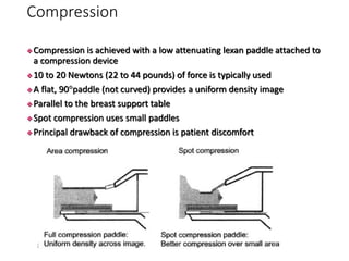 Mammography.pdf