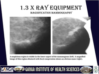 Mammogram Slides MAMMOGRAPHY /MAMMOGRAPHY SLIDE SHARE PPTX | PPTX