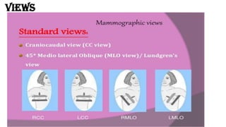 Mammography Positioning Guidebook.pdf mammography - Copy.pdfwertyuiytrewefghhfg | PDF