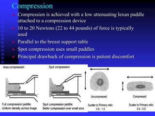 Mammography | PPTX