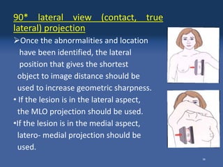 Mammography technique- Nischal Silakar.pptx