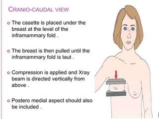 CRANIO-CAUDAL VIEW
 The casette is placed under the
breast at the level of the
inframammary fold .
 The breast is then pulled until the
inframammary fold is taut .
 Compression is applied and Xray
beam is directed vertically from
above .
 Postero medial aspect should also
be included .
 