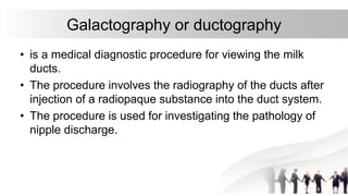 Dactography Types mammography | PPTX