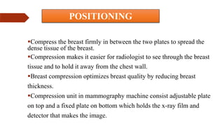 MAMMOGRAPHY VIEWS .ppt