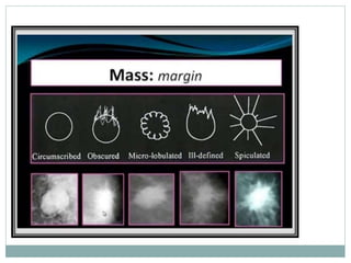 Mammogram Slides MAMMOGRAPHY final.pptx