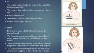  cc
 The casette is placed under the breast at the level of the
inframammary fold .
 The breast is then pulled until the inframammary fold is
taut .
 Compression applied
 Xray beam is directed vertically from above .
 Postero medial aspect included .
 MLO
 Best view to image all of the breast tissue and the
pectoral muscle .
 The C-arm of the mammographic unit is rotated to 45
degree so that the cassette is parallel to the pectoral
muscle .
 The film holder is kept high up in the axillary fossa and
the patients arm is abducted at the elbow by 80degrees.
 The x-ray beam enters the breast from the medial side –
compression is applied to the pectoralis major muscle .
 
