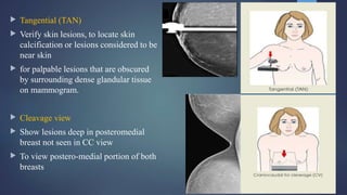  Tangential (TAN)
 Verify skin lesions, to locate skin
calcification or lesions considered to be
near skin
 for palpable lesions that are obscured
by surrounding dense glandular tissue
on mammogram.
 Cleavage view
 Show lesions deep in posteromedial
breast not seen in CC view
 To view postero-medial portion of both
breasts
 