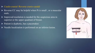  Caudo-cranial /Reverse cranio-caudal
 Reverse CC may be helpful when Pt is small , or a muscular
male.
 Improved resolution is needed for the suspicious area in
superior or the upper quadrant of breast.
 Patient is dyphotic, has a pacemaker.
 Needle localization is performed on an inferior lesion.
 