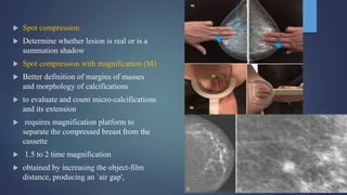  Spot compression
 Determine whether lesion is real or is a
summation shadow
 Spot compression with magnification (M)
 Better definition of margins of masses
and morphology of calcifications
 to evaluate and count micro-calcifications
and its extension
 requires magnification platform to
separate the compressed breast from the
cassette
 1.5 to 2 time magnification
 obtained by increasing the object-film
distance, producing an `air gap',
 