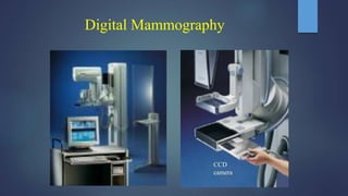 Digital Mammography
CCD
camera
 