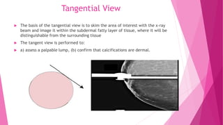 Tangential Radiograph Mammography positioning technique for Cranio Caudal (CC) | PPTX