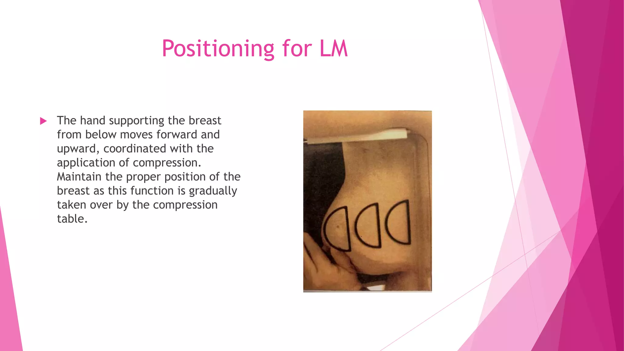 Compression Mammogram Mammography positioning technique for Lateral Views (LM/ML) | PPTX