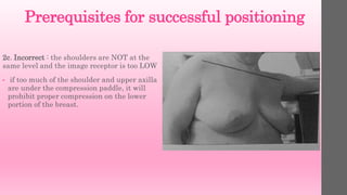 Prerequisites for successful positioning
2c. Incorrect : the shoulders are NOT at the
same level and the image receptor is too LOW
• if too much of the shoulder and upper axilla
are under the compression paddle, it will
prohibit proper compression on the lower
portion of the breast.
 