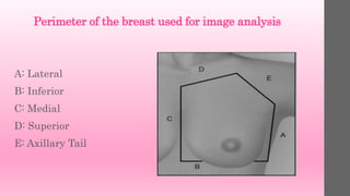 Perimeter of the breast used for image analysis
A: Lateral
B: Inferior
C: Medial
D: Superior
E: Axillary Tail
•
 