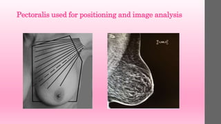 Pectoralis used for positioning and image analysis
 