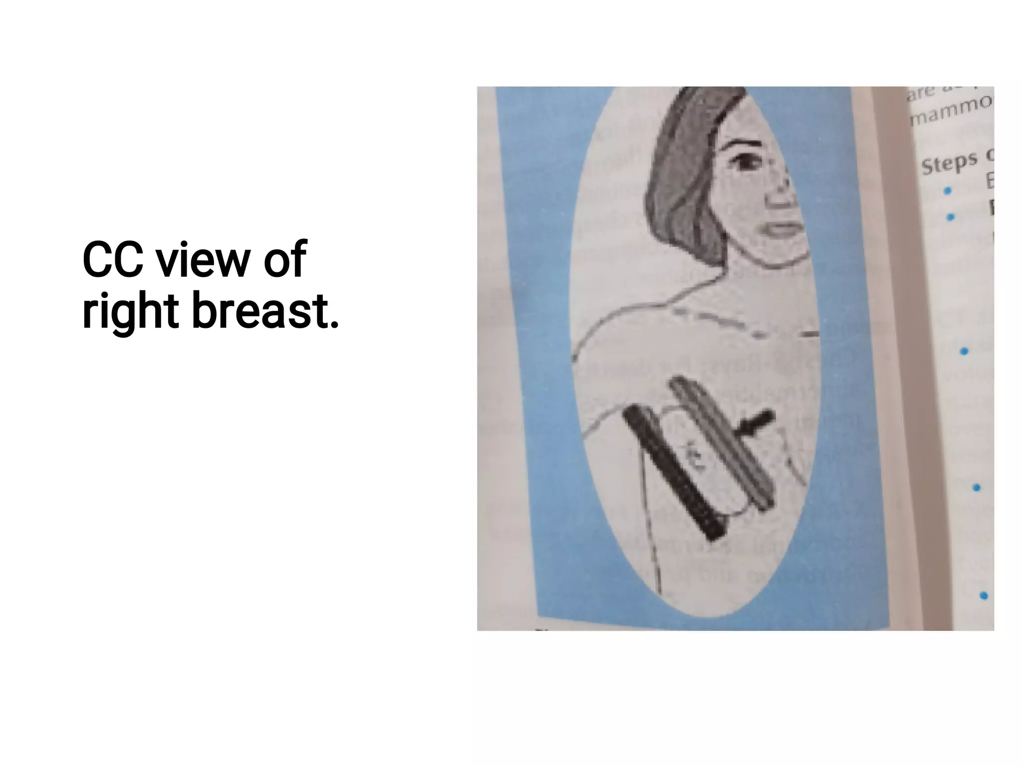 Mammography Positioning Guidebook.pdf Mammography (Radiology).pdf