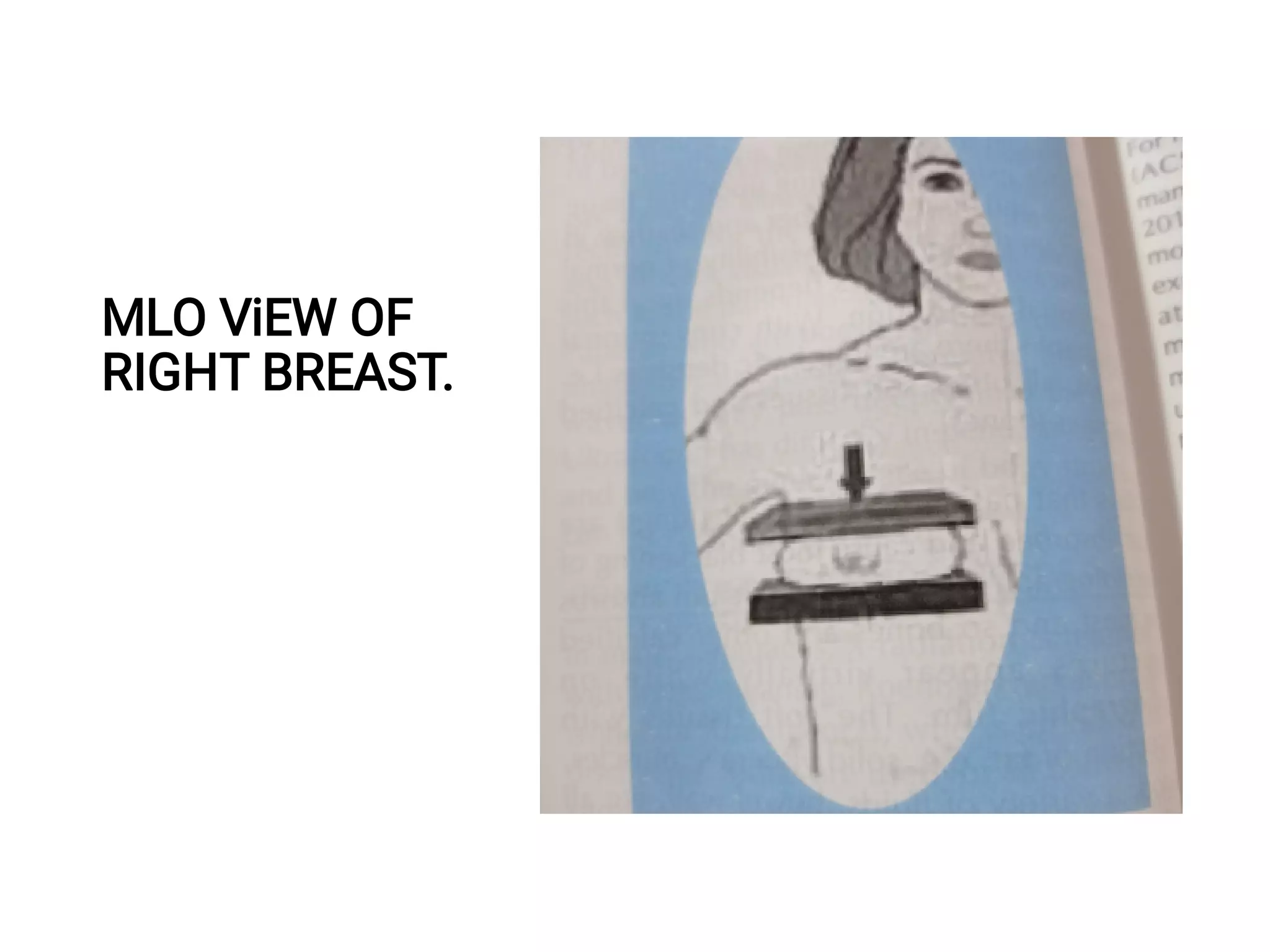 Mammography Positioning Guidebook.pdf Mammography (Radiology).pdf