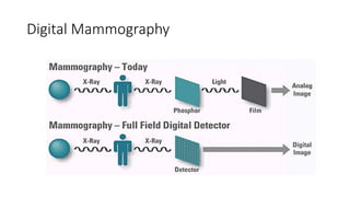 Mammography | PPTX