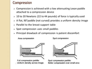 Compression Mammogram Comprehensive Overview of Mammography: Techniques, Equipment, and ...