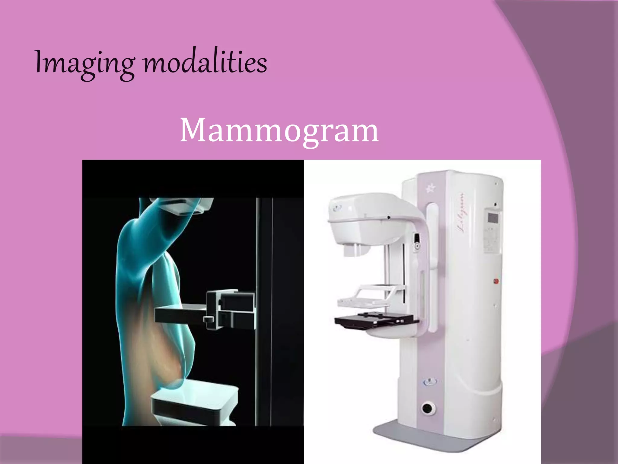 Mammography | PPT