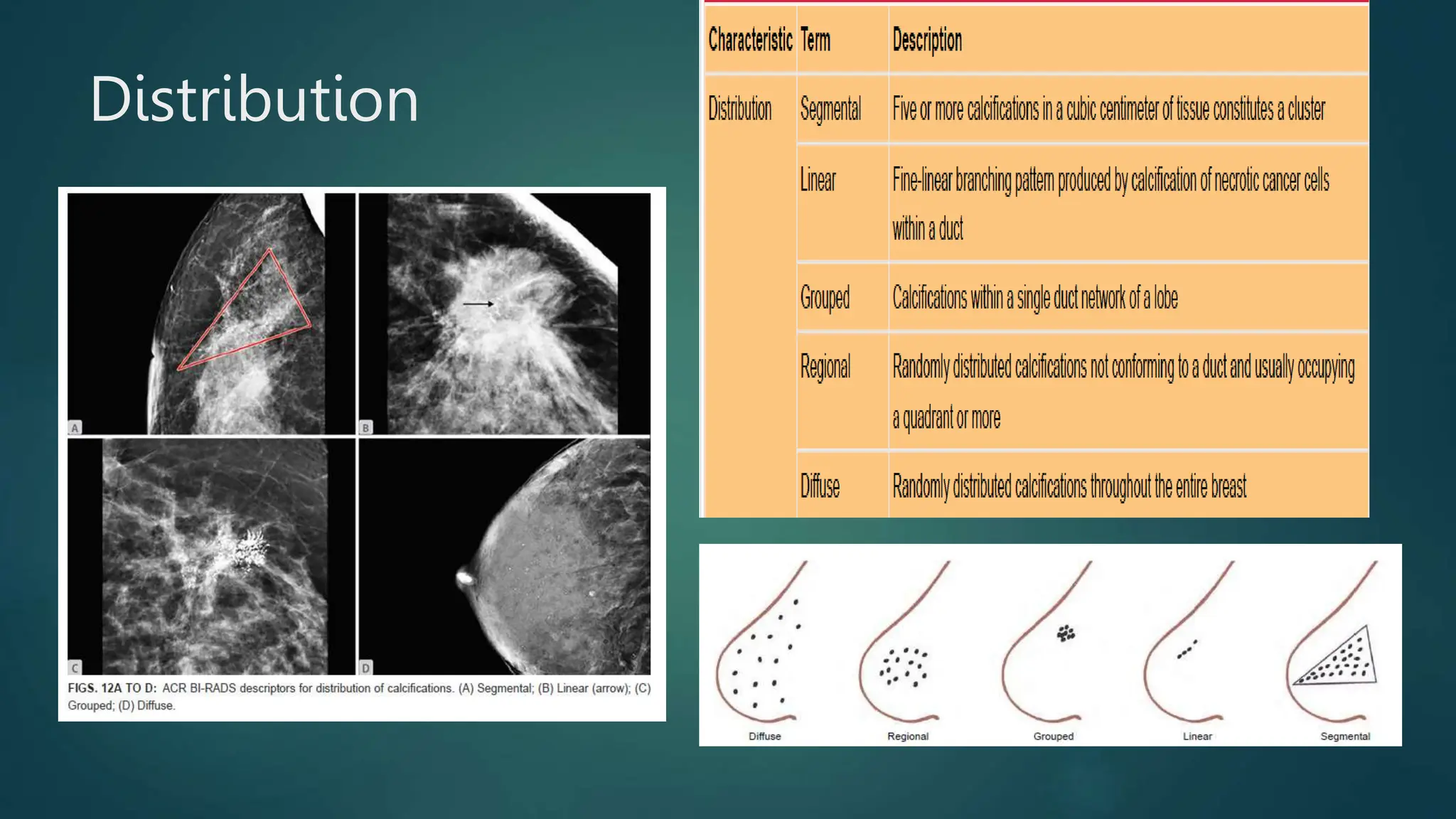 Mammography -A ppt bt J K PATIL, Prof,dept of radiology | PPTX