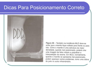 Dicas Para Posicionamento Correto
 