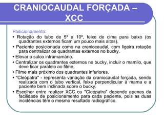 CRANIOCAUDAL FORÇADA –
         XCC
Posicionamento:
• Rotação do tubo de 5º a 10º, feixe de cima para baixo (os
    quadrantes externos ficam um pouco mais altos).
• Paciente posicionada como na craniocaudal, com ligeira rotação
    para centralizar os quadrantes externos no bucky.
• Elevar o sulco inframamário.
• Centralizar os quadrantes externos no bucky, incluir o mamilo, que
    deve ficar paralelo ao filme.
• Filme mais próximo dos quadrantes inferiores.
• "Cleópatra" - representa variação da craniocaudal forçada, sendo
    realizada com o tubo vertical, feixe perpendicular à mama e a
    paciente bem inclinada sobre o bucky.
• Escolher entre realizar XCC ou "Cleópatra" depende apenas da
    facilidade de posicionamento para cada paciente, pois as duas
    incidências têm o mesmo resultado radiográfico.
 