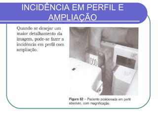 INCIDÊNCIA EM PERFIL E
      AMPLIAÇÃO
 