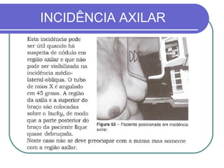 INCIDÊNCIA AXILAR
 