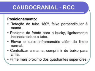 CAUDOCRANIAL - RCC
Posicionamento:
• Rotação do tubo 180º, feixe perpendicular à
   mama.
• Paciente de frente para o bucky, ligeiramente
   inclinada sobre o tubo.
• Elevar o sulco inframamário além do limite
   normal.
• Centralizar a mama, comprimir de baixo para
   cima.
• Filme mais próximo dos quadrantes superiores.
 