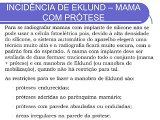 INCIDÊNCIA DE EKLUND – MAMA
       COM PRÓTESE
 