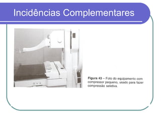 Incidências Complementares
 