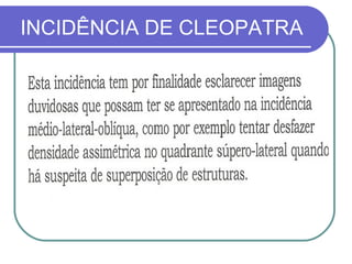 INCIDÊNCIA DE CLEOPATRA
 