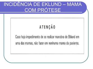 INCIDÊNCIA DE EKLUND – MAMA
       COM PRÓTESE
 