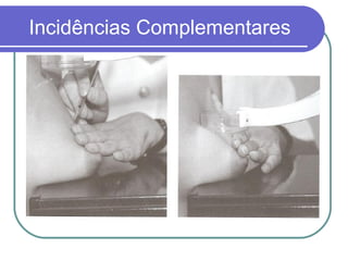 Incidências Complementares
 
