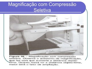 Magnificação com Compressão
           Seletiva
 