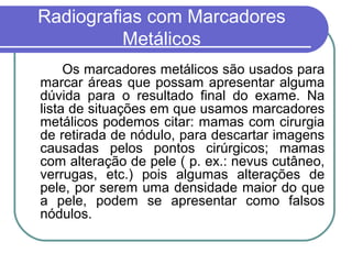 Radiografias com Marcadores
          Metálicos
     Os marcadores metálicos são usados para
marcar áreas que possam apresentar alguma
dúvida para o resultado final do exame. Na
lista de situações em que usamos marcadores
metálicos podemos citar: mamas com cirurgia
de retirada de nódulo, para descartar imagens
causadas pelos pontos cirúrgicos; mamas
com alteração de pele ( p. ex.: nevus cutâneo,
verrugas, etc.) pois algumas alterações de
pele, por serem uma densidade maior do que
a pele, podem se apresentar como falsos
nódulos.
 