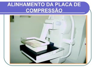 ALINHAMENTO DA PLACA DE
      COMPRESSÃO
 