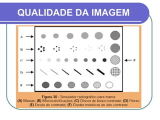 QUALIDADE DA IMAGEM
 
