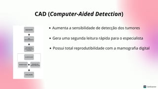 CAD (Computer-Aided Detection)
Aumenta a sensibilidade de detecção dos tumores
Gera uma segunda leitura rápida para o especialista
Possui total reprodutibilidade com a mamografia digital
 