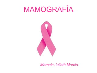 MAMOGRAFÍA




   Marcela Julieth Murcia.
 