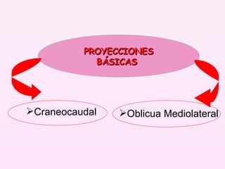 PROYECCIONES BÁSICAS  Oblicua Mediolateral Craneocaudal 