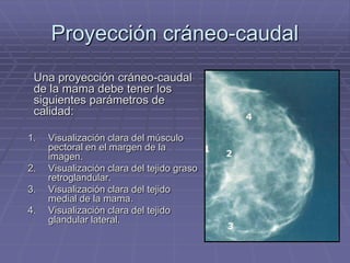 MamógrafoEl mamógrafo se compone de:Arco basculanteTubo de rxPalas de compresiónPortachasisPedalesMampara plomadaCuadro de mandos