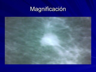 Magnificación 