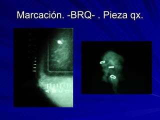 Marcación. -BRQ- . Pieza qx. 